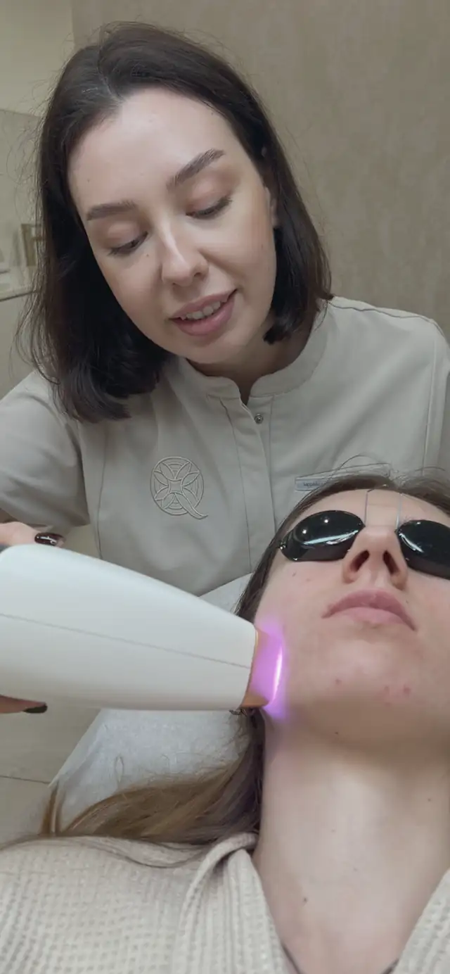 Laserowe leczenie trądziku Mediostar Monolith w Quality House of Beauty