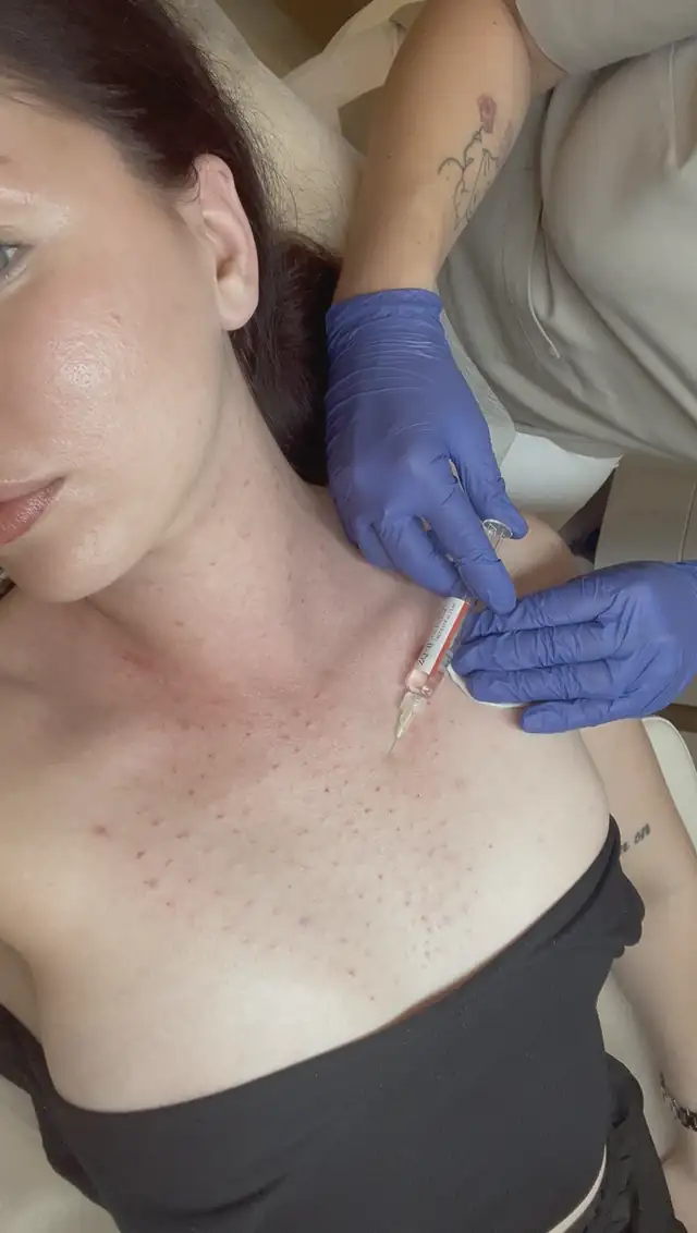Biorewitalizacja w Quality House of Beauty