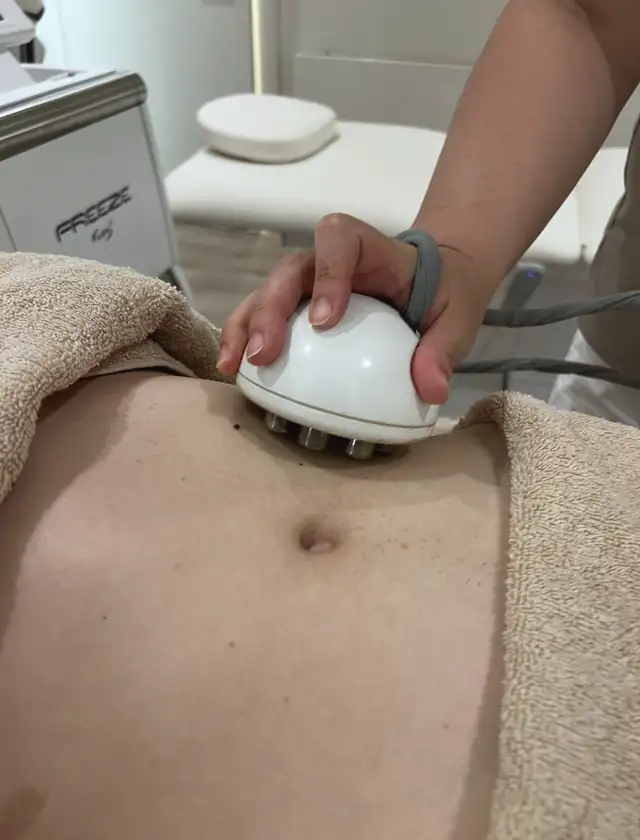 Venus Freeze w Quality House of Beauty